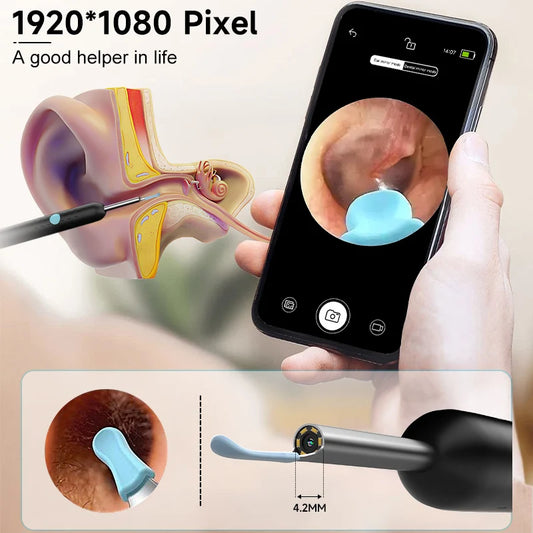 Visual WiFi Ear Cleaner