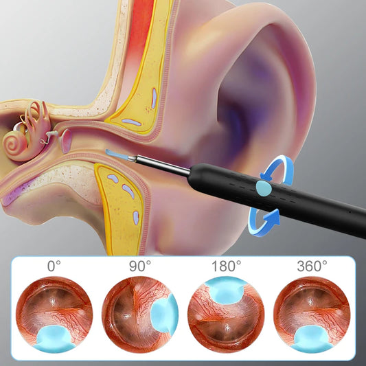 Visual WiFi Ear Cleaner